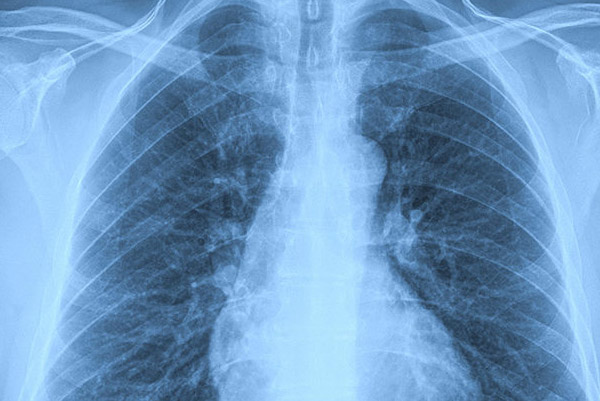 Xrays Dusk to Dawn Urgent Care Xrays Dusk to Dawn Urgent Care