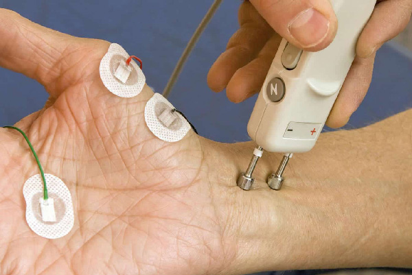 Nerve Study Dusk to Dawn Urgent Care Nerve Study Dusk to Dawn Urgent Care